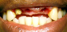 Orange New Jersey dental implants image