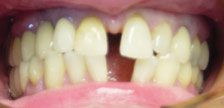 Orange New Jersey dental implants image